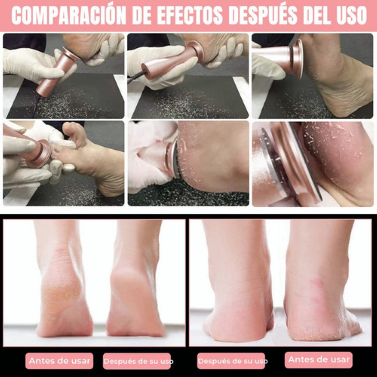 M&aacute;quinas Exfoliadoras Removedor De Callos Lima Para Pies Gold image number null