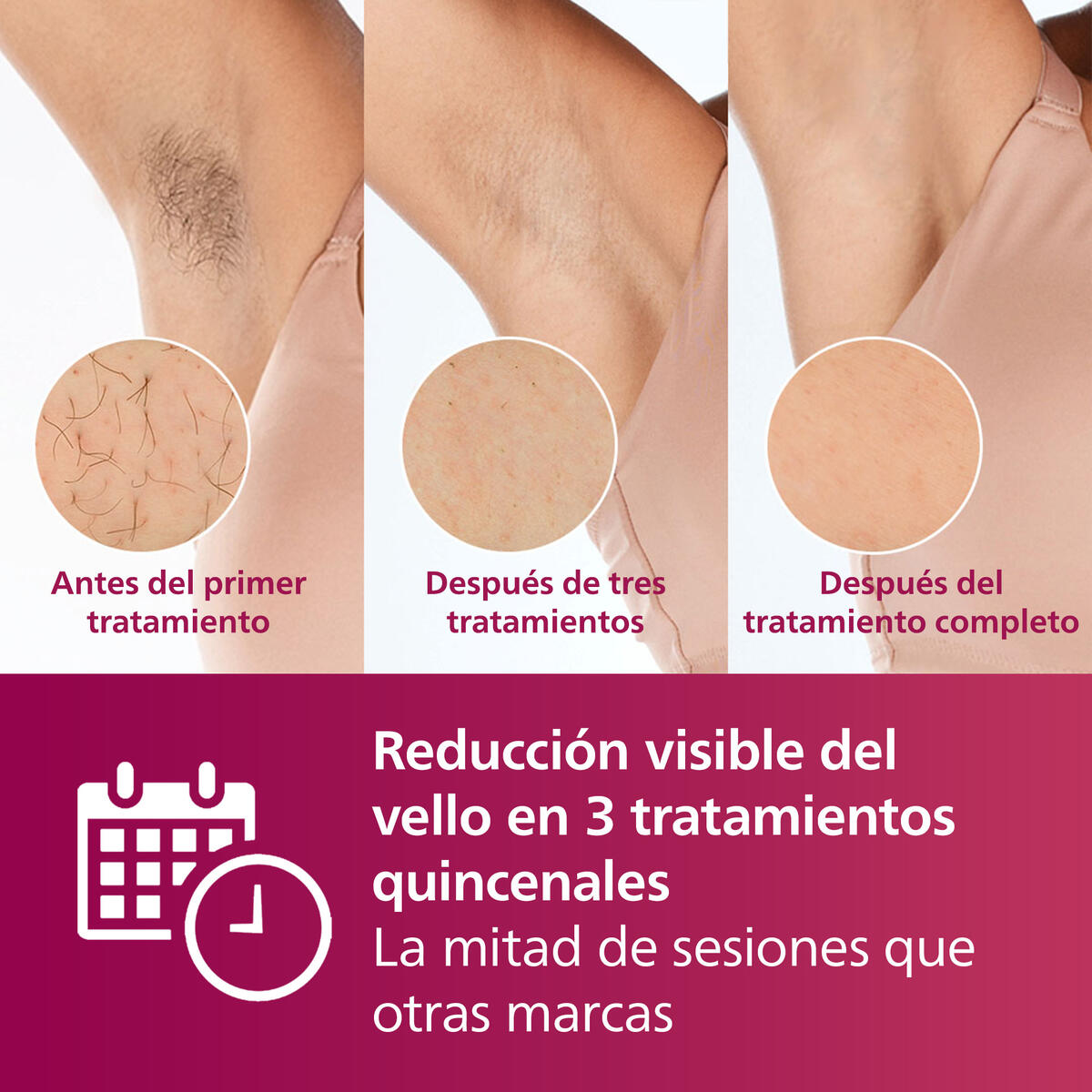 Depiladora Lumea Philips SC1997/50 image number null